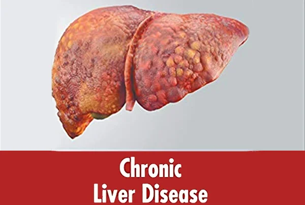 Chronic Liver Disease